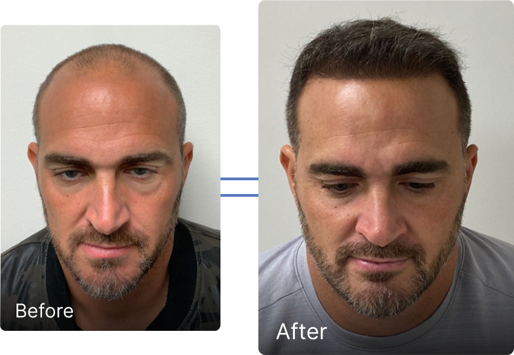 Before and after result 2